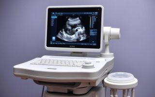 Как выбрать УЗИ аппарат: полезное руководство для начинающих и профи