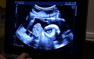 УЗИ-диагностика: как это работает, зачем нужна и чего ожидать на приёме