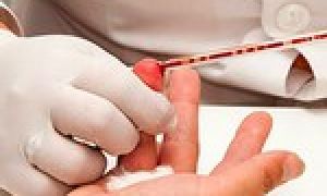 Как правильно сдать кровь на сахар с нагрузкой